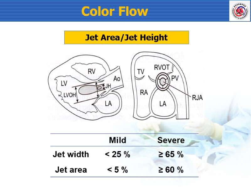 Color Flow Jet Area/Jet Height